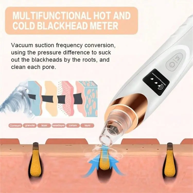 BLACK HEADS ACNE OIL REMOVER 5 in 1 Glamour Store
